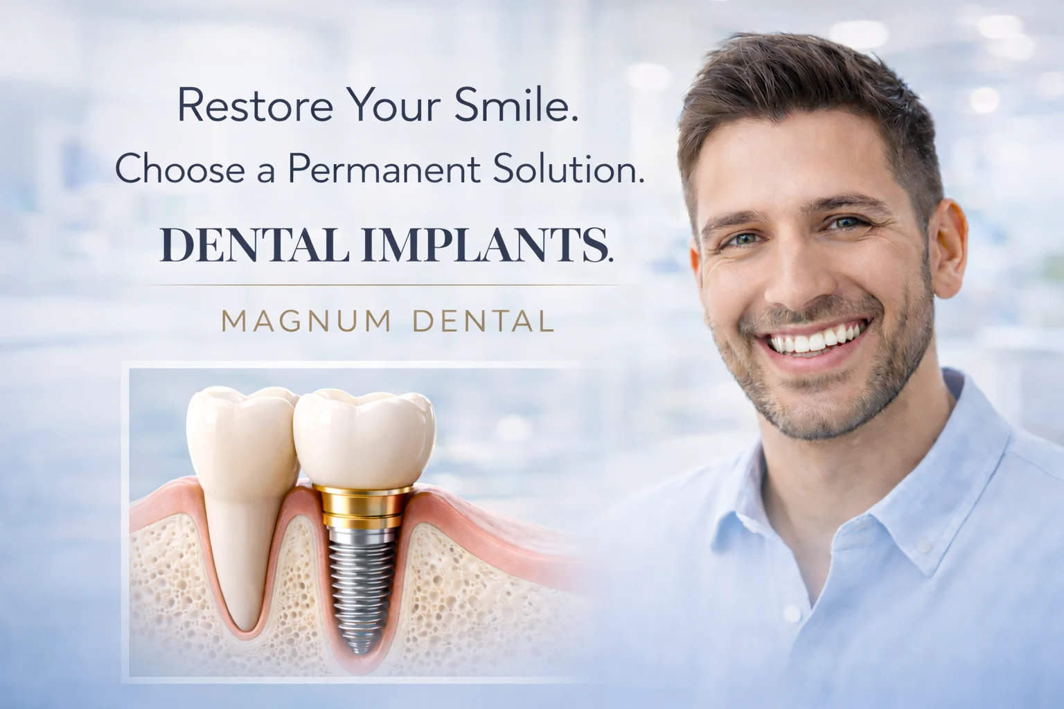 Dental implants for permanent tooth replacement